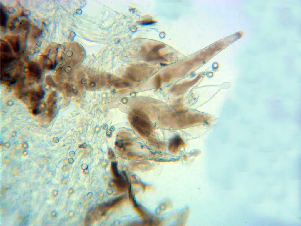 Microscopía de Pluteus exiguus - 19 - Pileipellis x 400 2